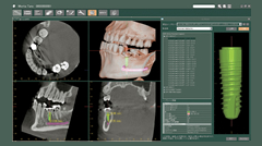 歯科用CTの特徴
